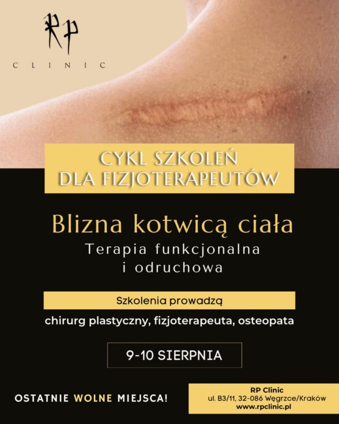 Blizna kotwicą ciała - zapisz się na szkolenie 12 Blizna kotwicą ciała – zapisz się na szkolenie