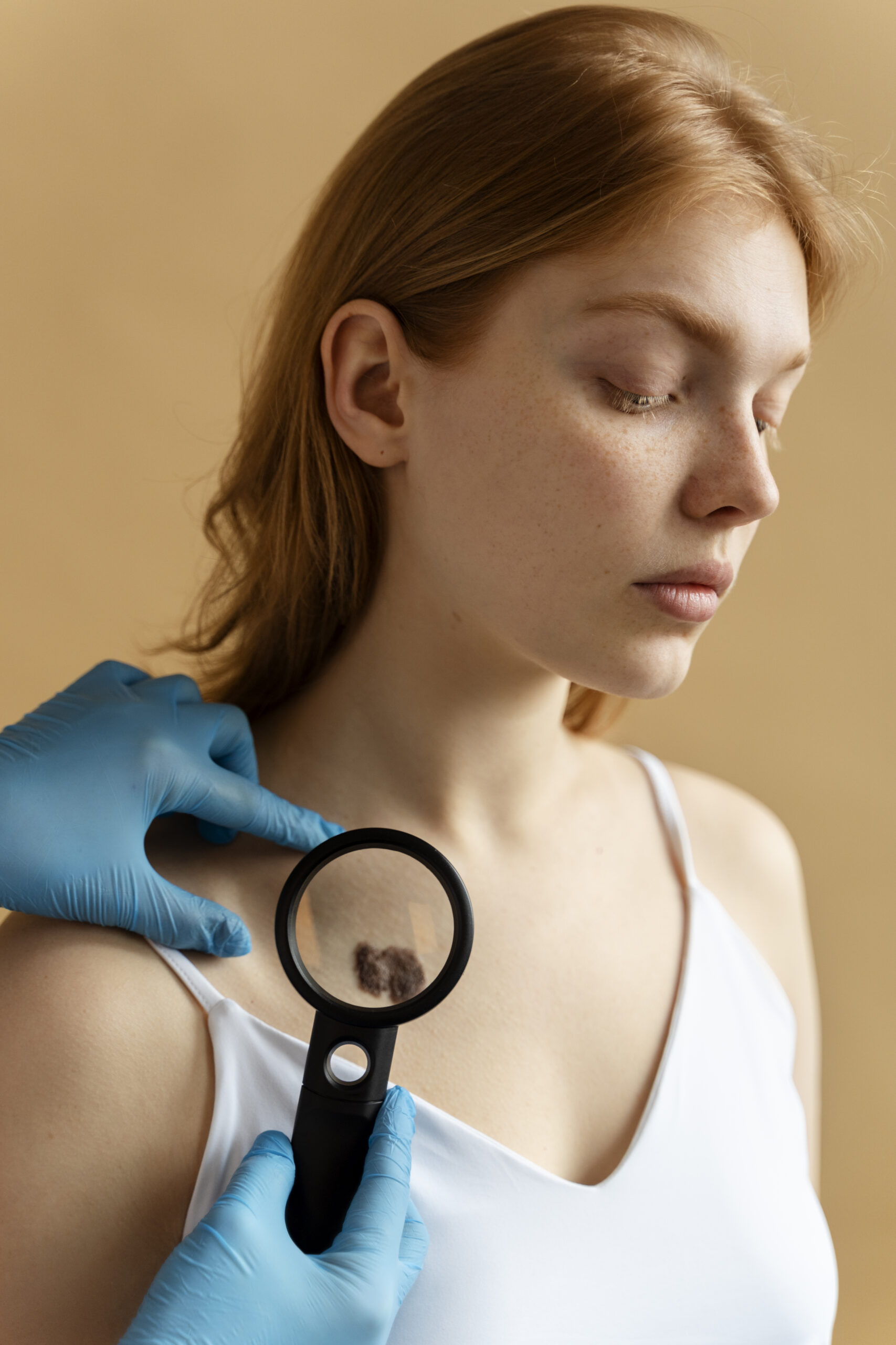 young woman with big mole side view scaled