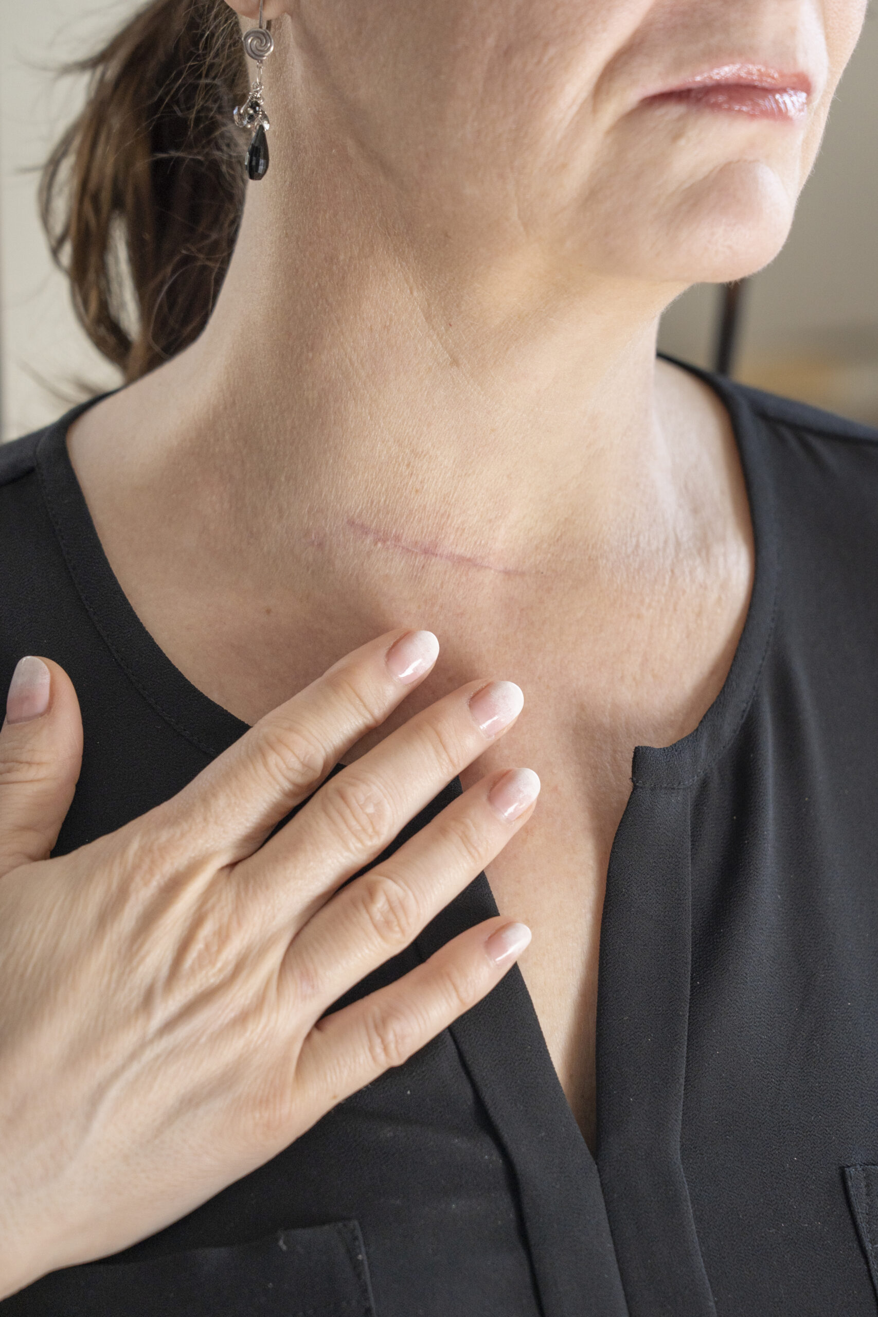 close up woman with hands scaled