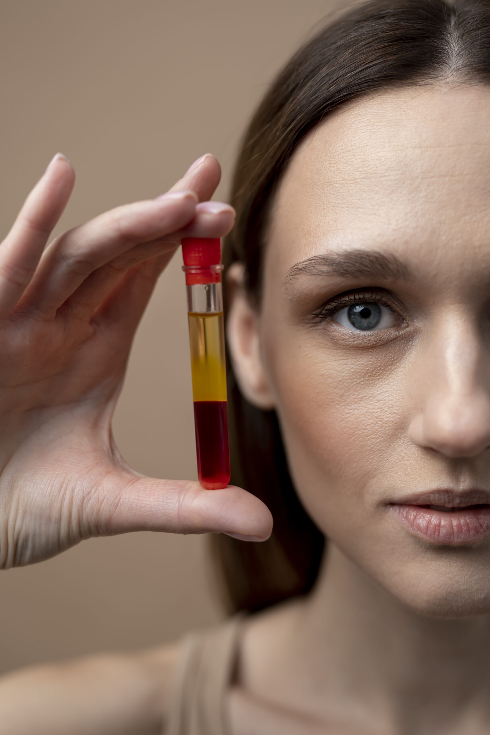 young woman holding prp vial scaled